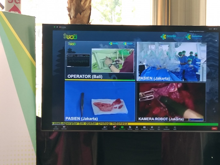 A screen at the lobby of Cipto Mangunkusumo Central General Hospital (RSCM) in Jakarta shows pictures of the telerobotic surgery to remove cyst from a patient's kidney on Aug. 30, 2024. The lead doctor in the procedure, urological surgeon Ponco Birowo, led the surgery from Denpasar, Bali, while the patient was at the surgeon theater in Jakarta.